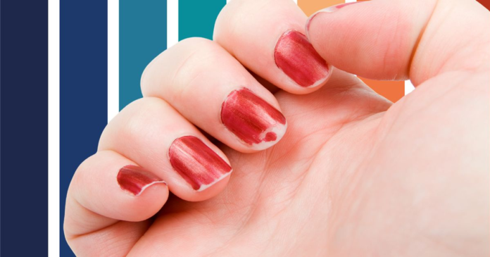 This Seemingly Harmless Habit Can Be Even Worse For Your Nails Than Biting